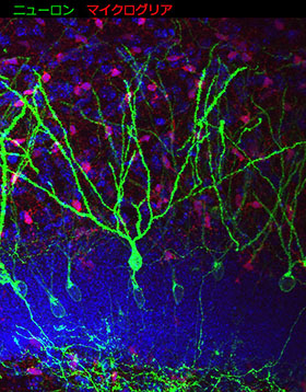 神経発達障害におけるニューロン・グリア相関の研究の画像